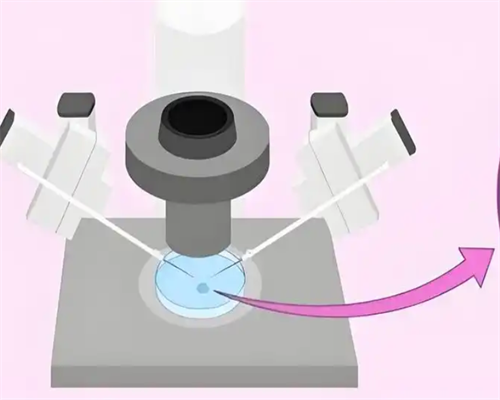 移植准备：降调人工周期开启